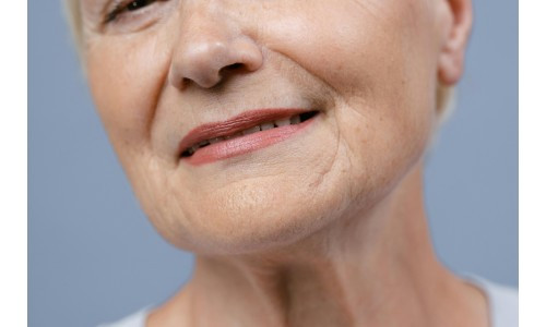 Actifs anti-taches : les ingrédients clés pour une peau uniforme